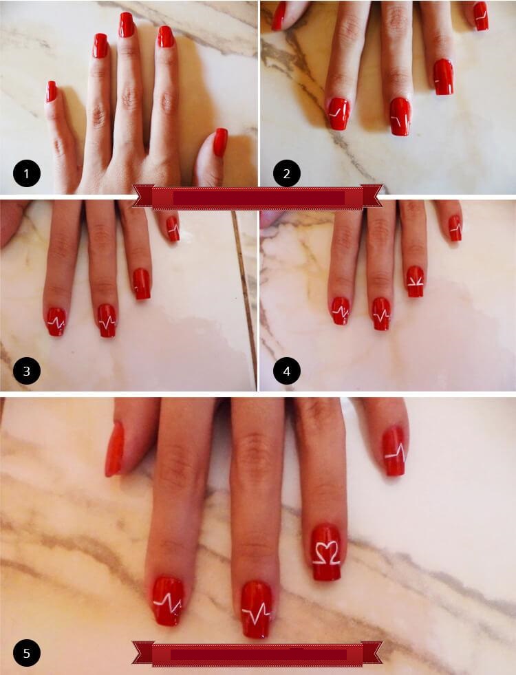 électrocardiogramme étape par étape